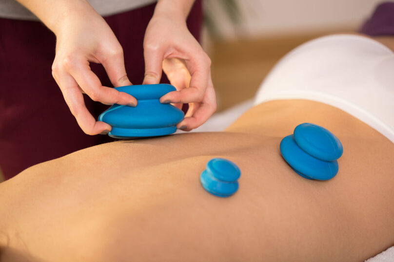 Cupping Massage Cupping Massage