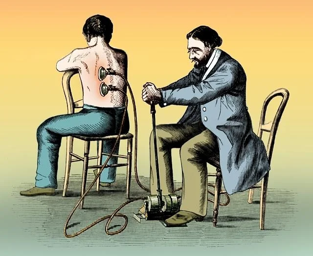 Hijamah (Wet Cupping) Hijamah (Wet Cupping)