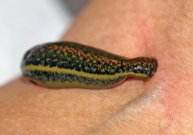Leech therapy Leech therapy