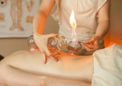fire-cupping fire-cupping