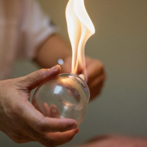 Benefits of Hijama Therapy