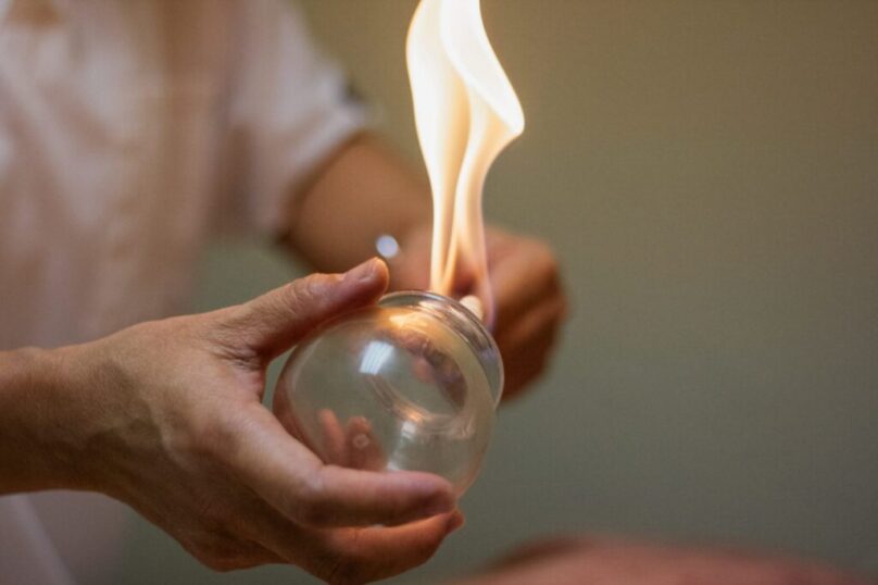 Benefits of Hijama Therapy Benefits of Hijama Therapy