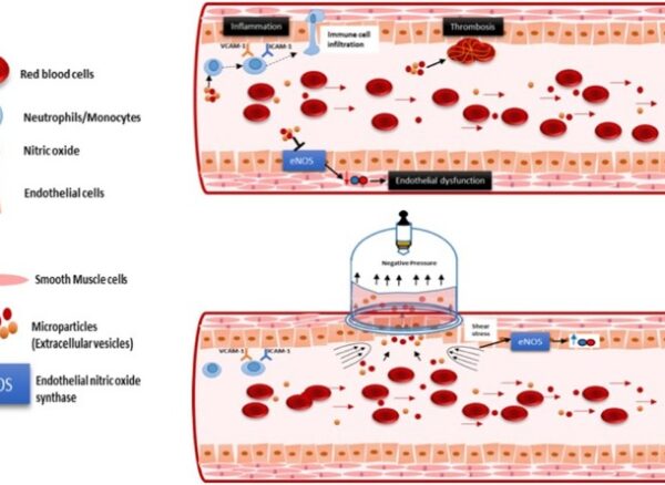 Scientific and Therapeutic Evidence of Hijama (Cupping Therapy)