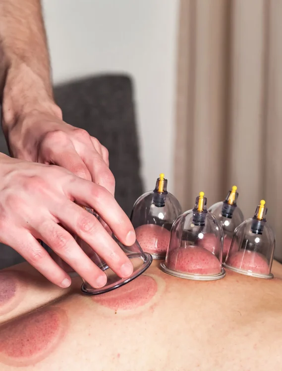 hijama-in-usa hijama-in-usa