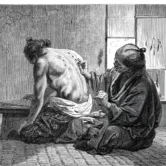 Black Magic and Hijama