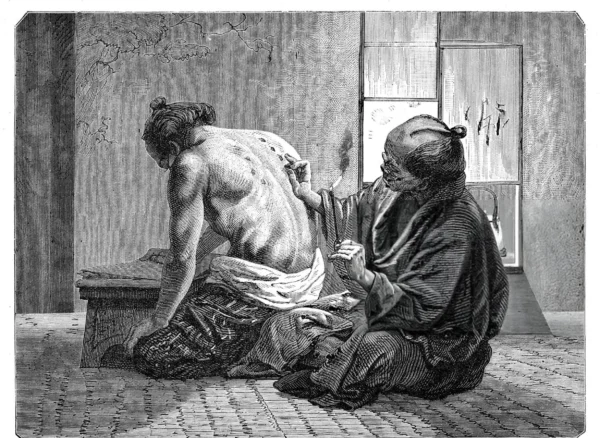 Black Magic and Hijama