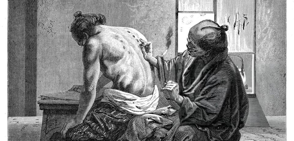 Black Magic and Hijama