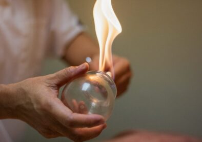 Fire Cupping Fire Cupping