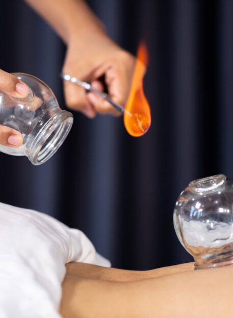 Fire Cupping video Fire Cupping video